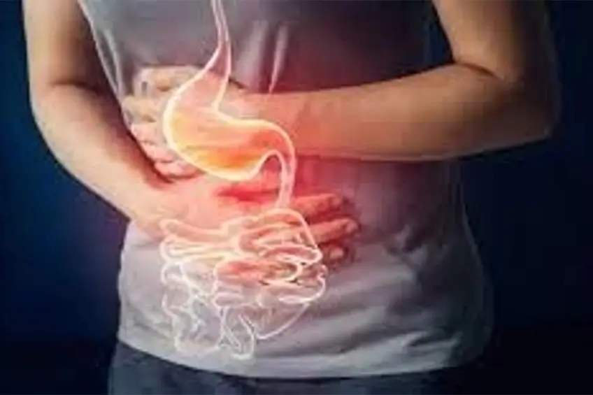 Mide Fıtığı Tedavisi Mide Fıtığı Tedavisi